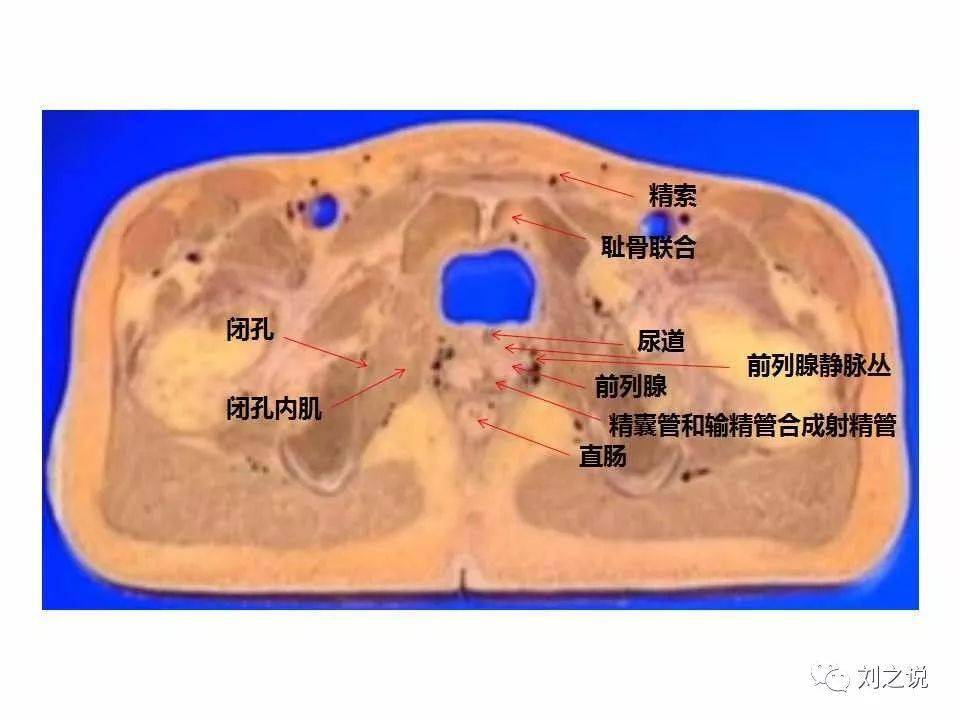 收藏必备:男性盆腔断层解剖