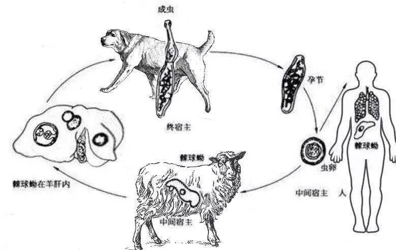 28岁小伙肝脏巨大囊肿满是寄生虫卵