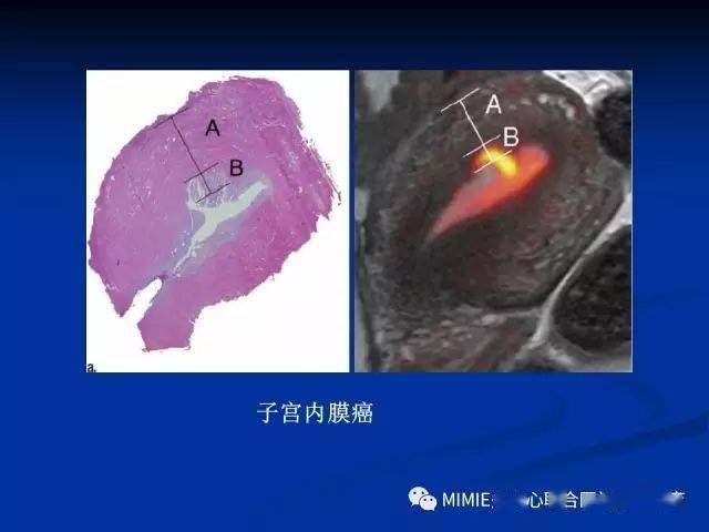 女性生殖系统正常解剖及表现