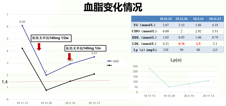 该患者在首次胸痛发作后冠脉造影发现多处瘤样扩张及左回旋支完全闭塞