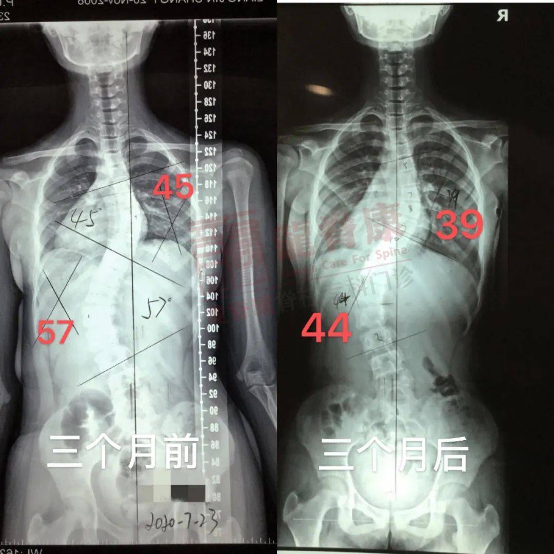 头部核磁忘了脱内衣_头部核磁(3)