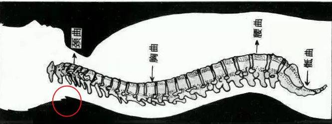 颈椎经常落枕怎么办