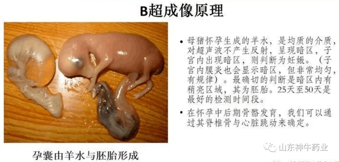 【技术】如何使用b超做好妊检工作!