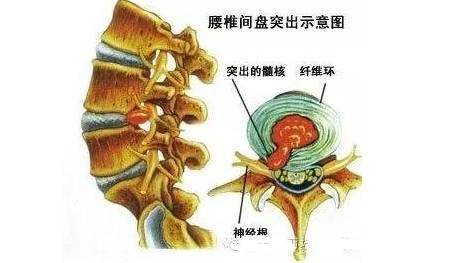 疼痛治疗相关定点方法及具体定点治疗_部位