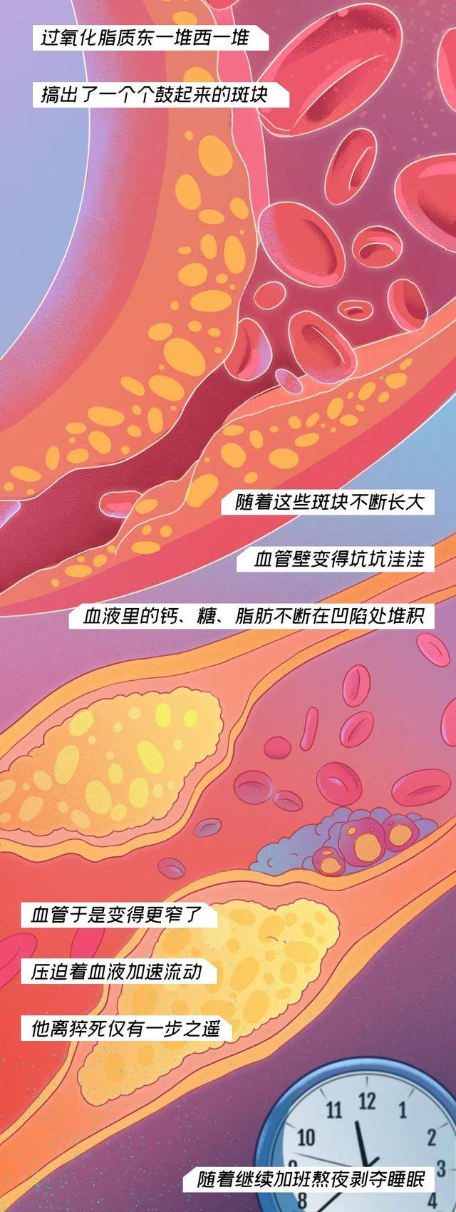 一个90后员工猝死的全过程