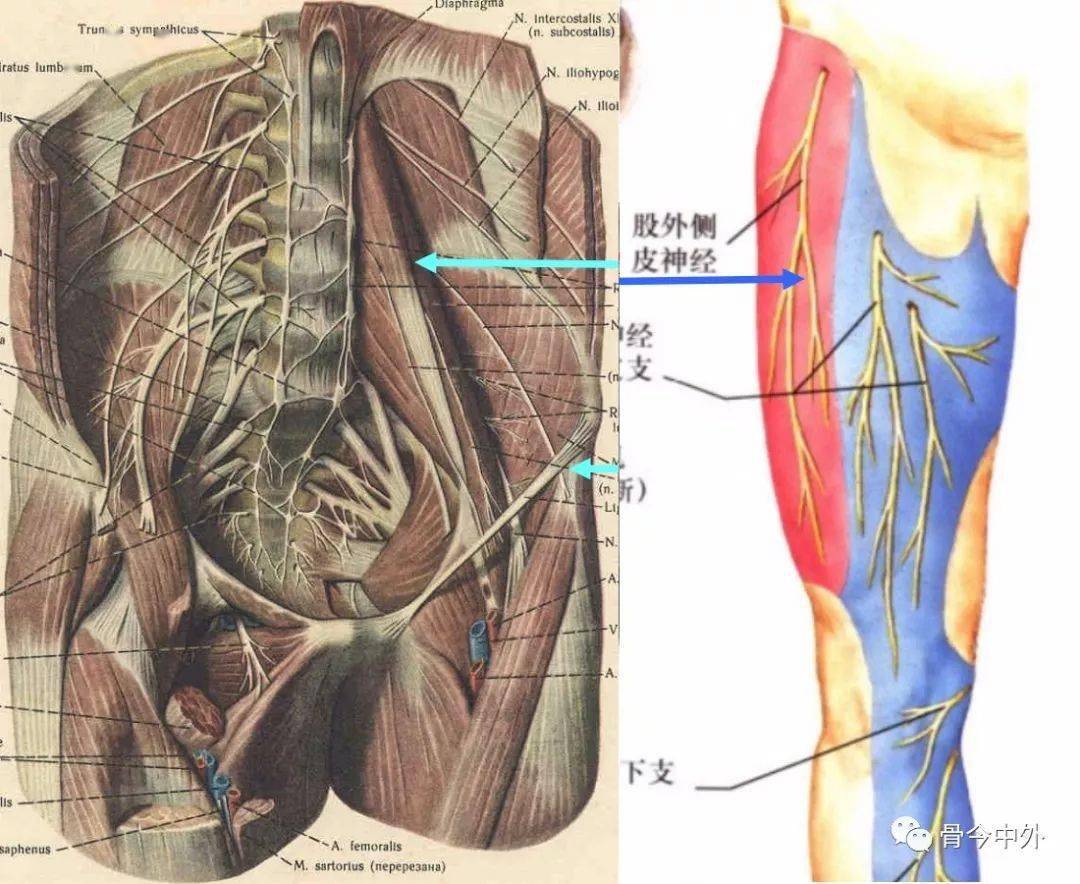解剖走形:股外侧皮神经从腰大肌外侧缘穿出经腹股沟韧带深面分布到股
