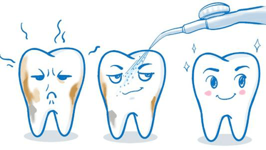 定期洗牙是否有必要看了你就知道