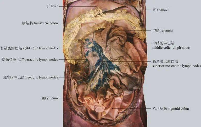 图6-70 腹后壁淋巴结  lymph nodes at posterior abdominal wall