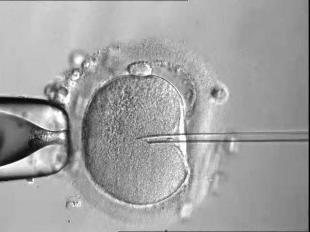 卵胞浆内单精子注射适用于极度少精,弱精患者,用以上的方式  不能体外