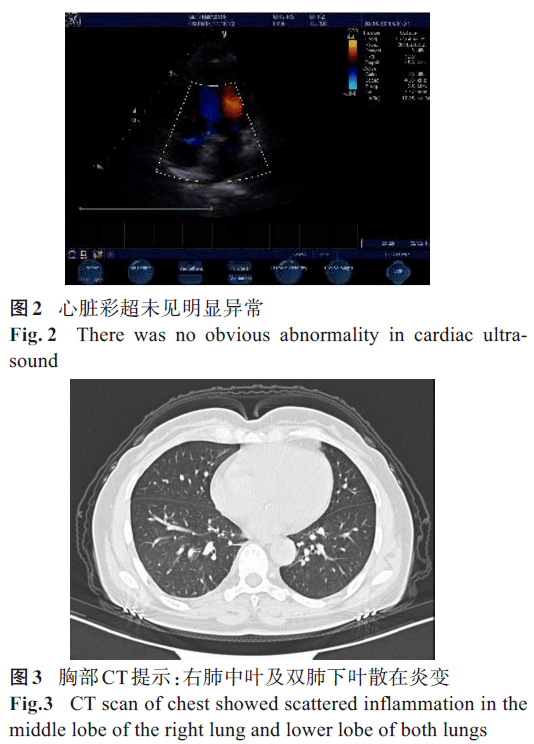 误诊为耳廓软骨膜炎的复发性多软骨炎1例