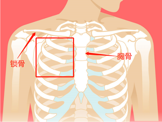 左下的位置:左乳外侧电极片中线在腋中线,电极片上缘距腋窝月7cmz左右