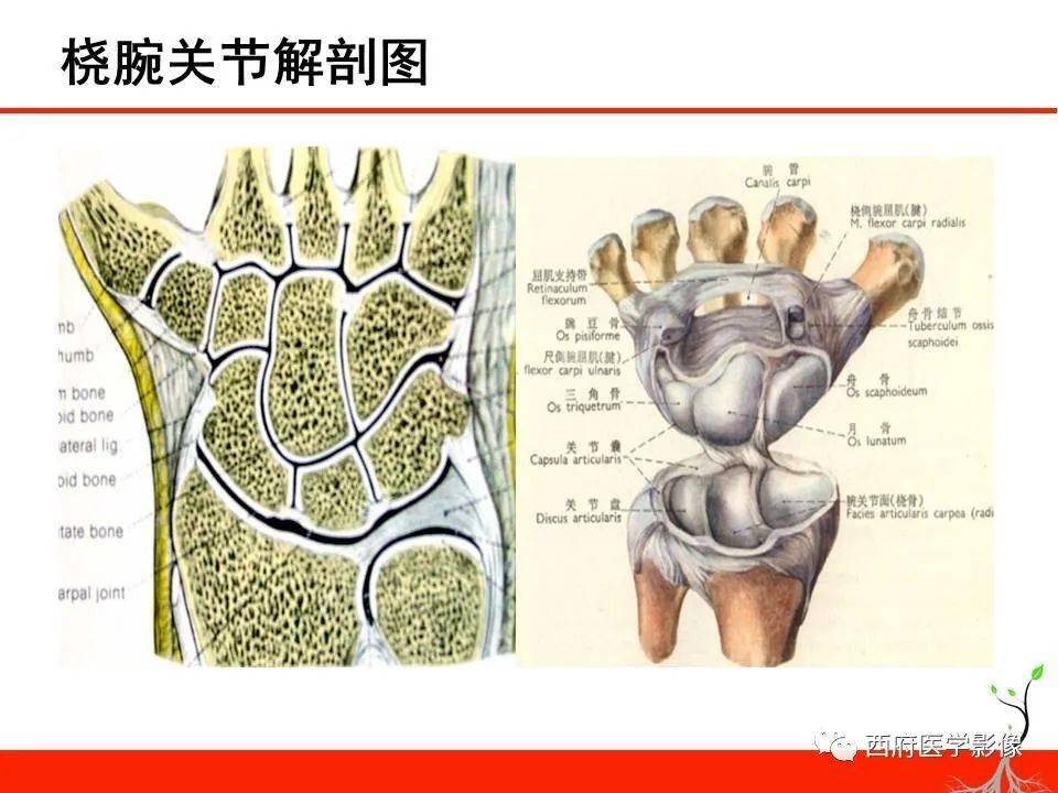 成人腕关节外伤x线诊断