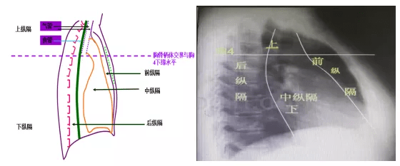 下纵隔的分界;以气管,升主动脉及心脏前缘的连线做为前,中纵隔的分界