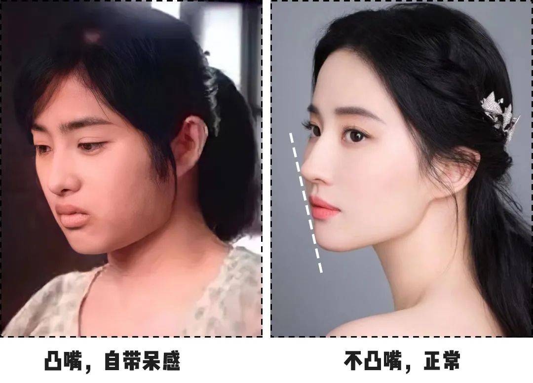 但比较明显的凸嘴就真真的显土气,有一种憨憨的感觉.