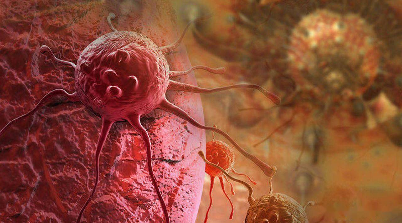 癌细胞是永生细胞,如果人死了,它还能活吗?