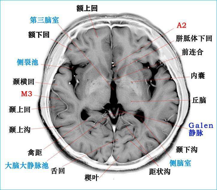 这个高清颅脑断层解剖图谱实在太棒了!【磁共振