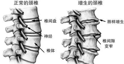 医文医话沈明球心悸胸闷背痛或是颈椎出了问题