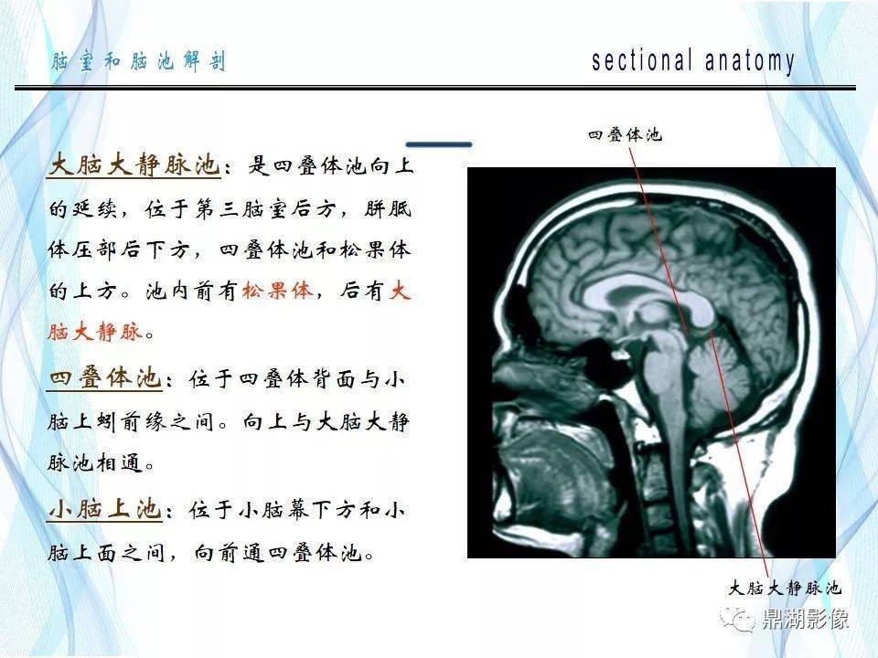 超全详解脑池和脑室断层解剖