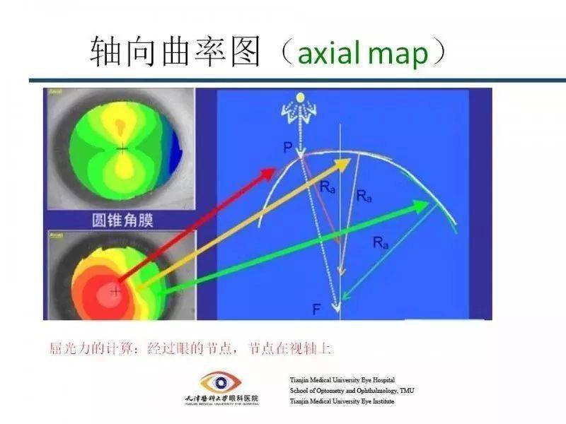 这个曲率中心不是该点真正意义上的曲率中心 主要反映角膜屈光度和