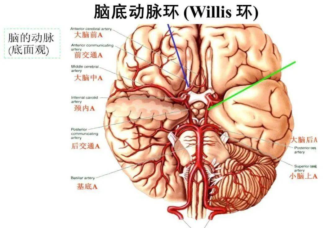 从梗死部位推测责任血管:脑血管解剖