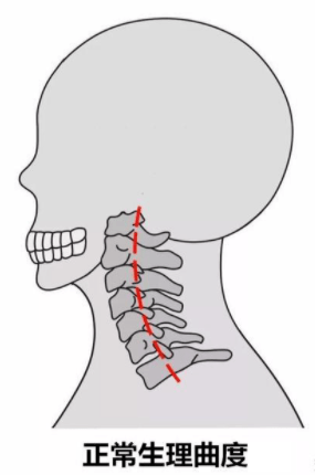 其实,我们的脊椎并非一条直线,而是存在四个生理弯曲,正常的颈椎就是