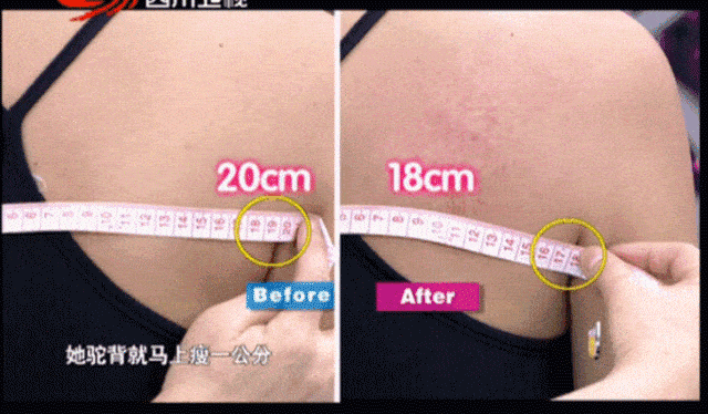 给  叶一茜3分钟经络按摩,腿围缩小  1cm!