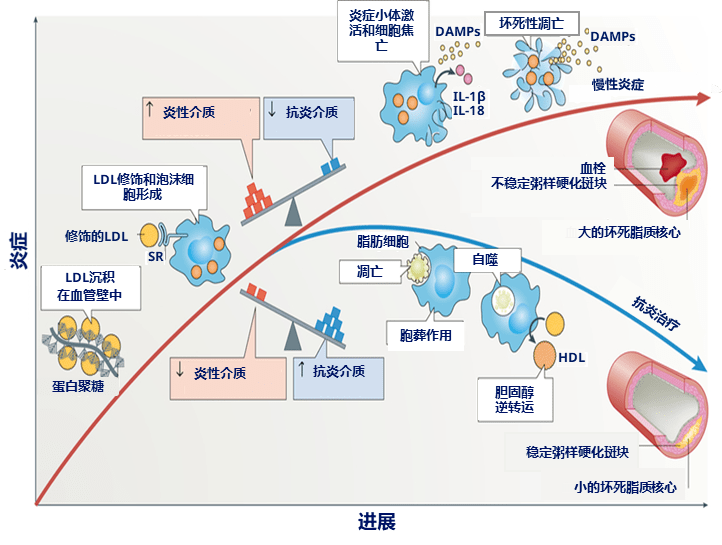 【糖尿病学术前沿】冠状动脉粥样硬化性心脏病治疗理念变迁——从以