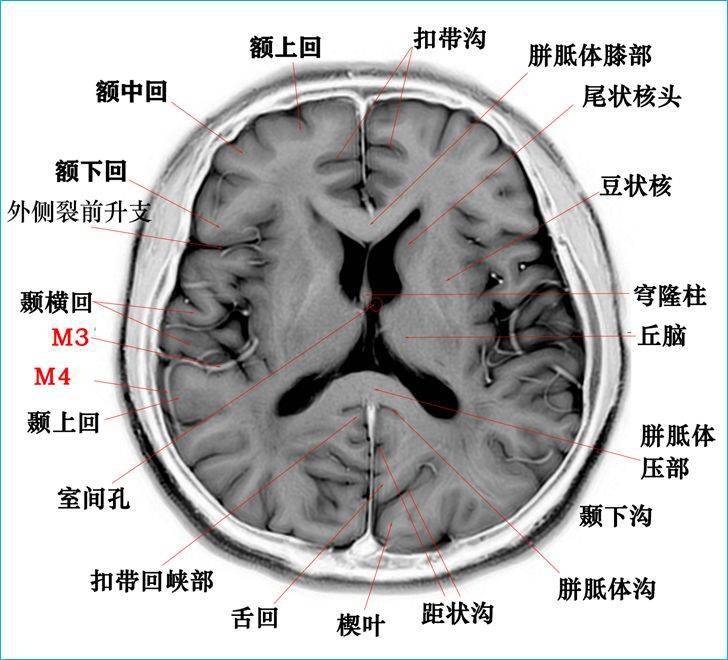 影像必备高清颅脑mr断层解剖图谱