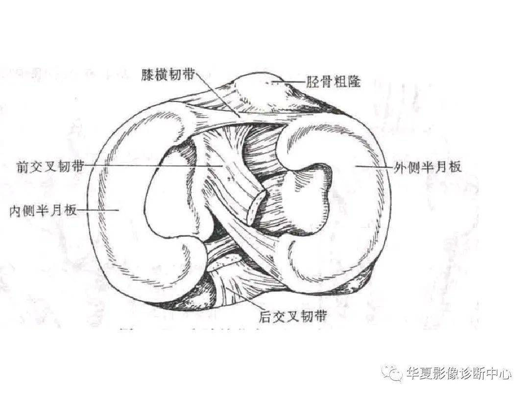 交叉韧带解剖及损伤的mri诊断