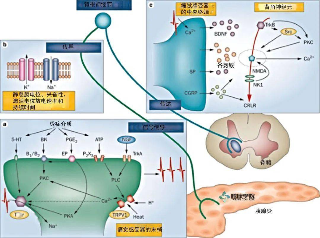 慢性胰腺炎