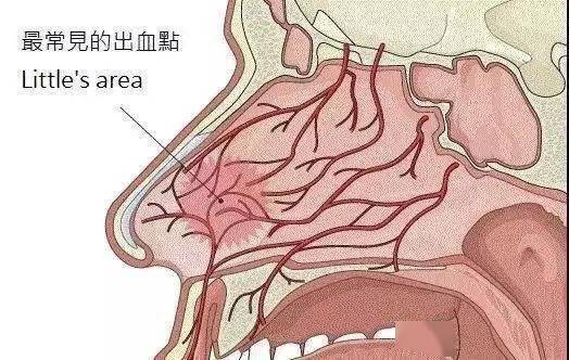 健康幸福过大年春节期间鼻子流血不要用纸巾堵正确的做法是