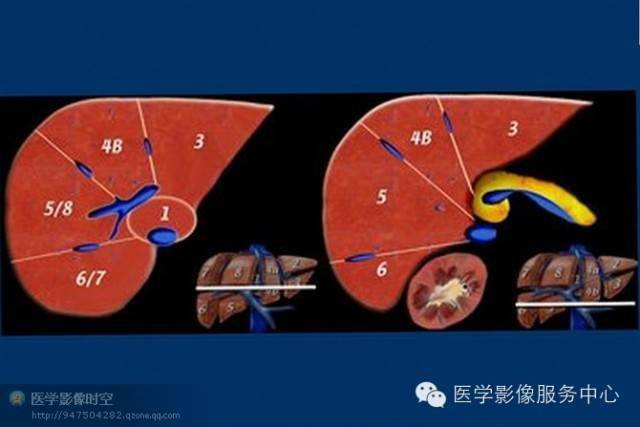 最全肝段解剖图解
