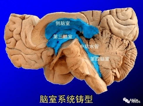 脑室系统 侧脑室 第三脑室 第四脑室(第五脑室 第六脑室 中脑水管