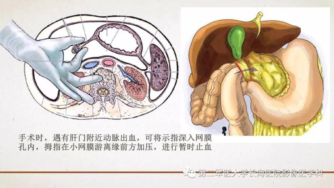 腹膜相关结构的影像解剖