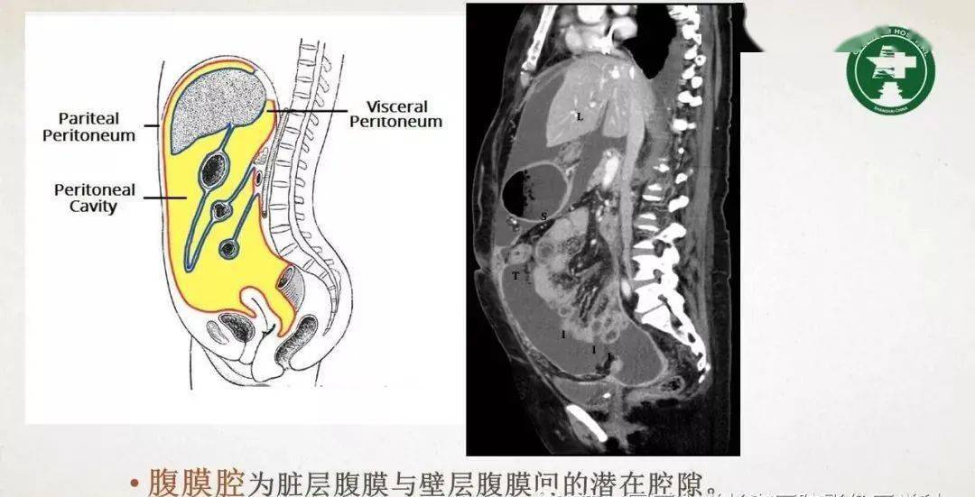 腹膜相关结构的影像解剖