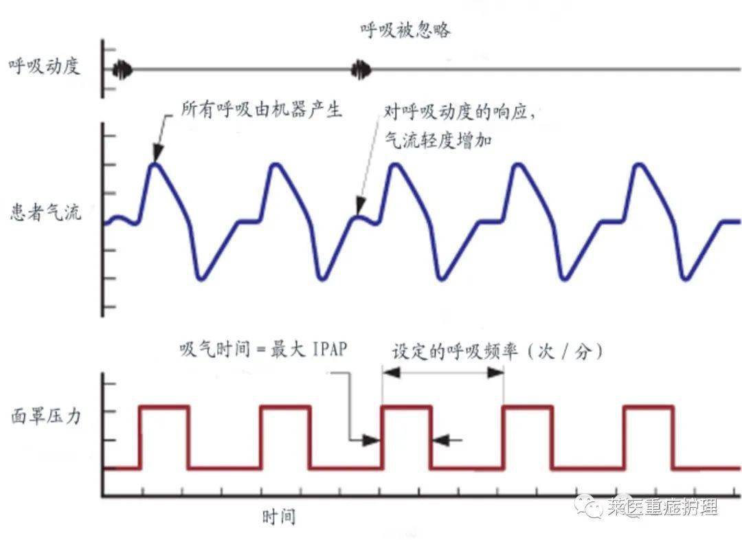 呼吸机工作原理 来自搜狐网