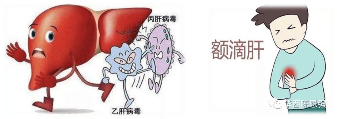 请"肝区隐痛"的"你"看过来