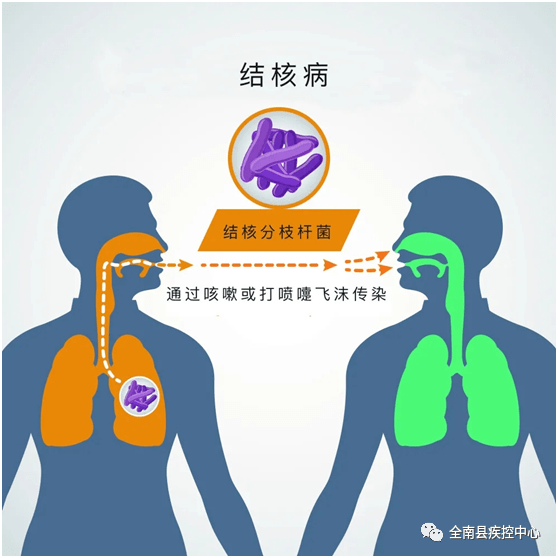结核病的传染源来自哪里?
