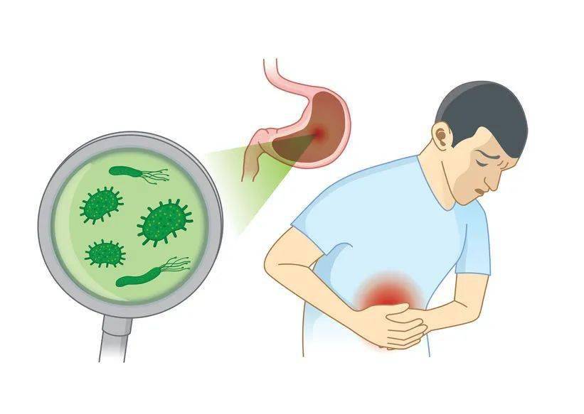 幽门螺杆菌,感染8亿中国人,1人中招传染全家,这些知识你需要知道