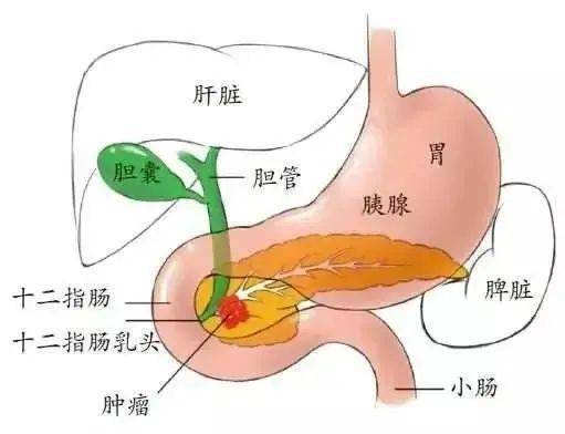 38岁女士眼睛莫名发黄,居然是这里长了个肿瘤!