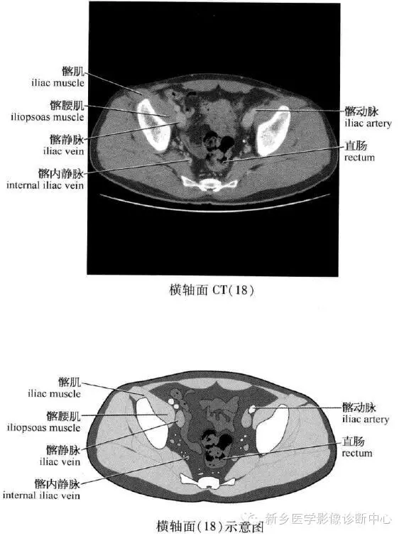 史上最全!腹部横断位解剖 详细标注