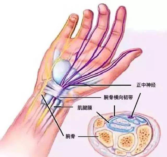 长期压迫正中神经,会导致拇指,食指,中指的感觉丧失,肌肉萎缩,手部