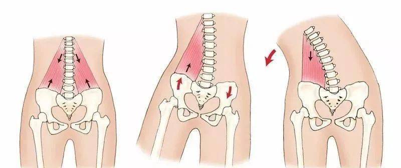腰方肌位置图腰方肌起自第12肋骨下缘和第1-4腰椎横突髂嵴的后部,止于