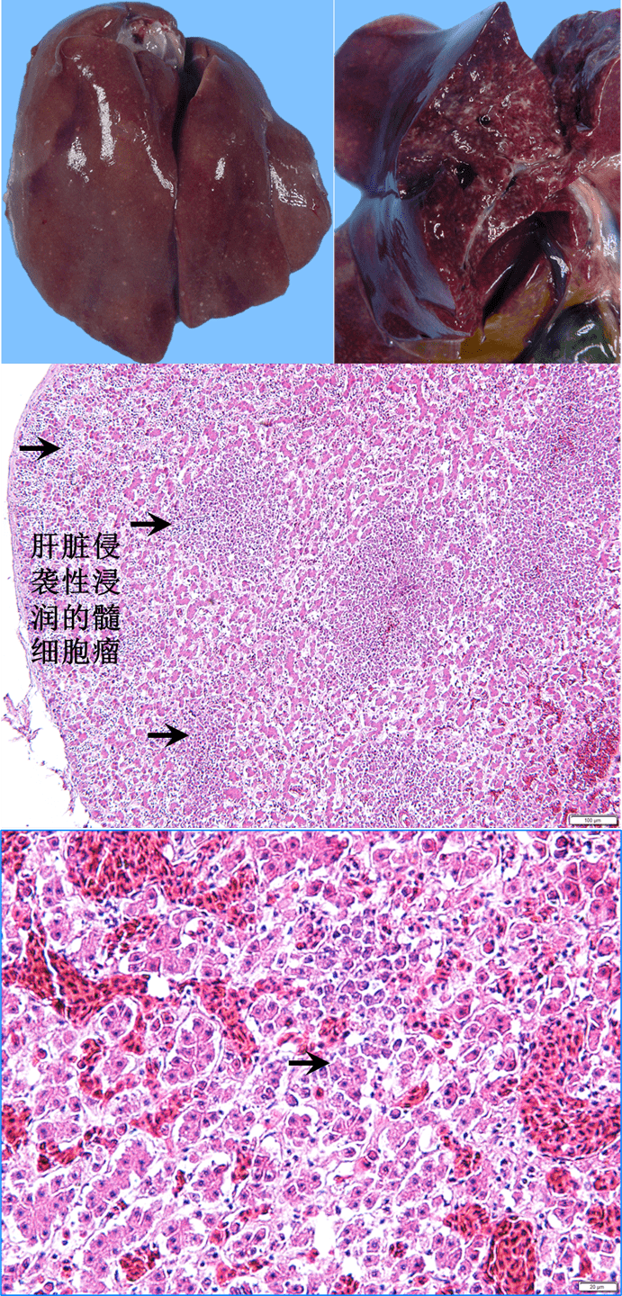 干货分享小心肝又破了鸡肝破裂病例的组织病理学观察与类病诊断