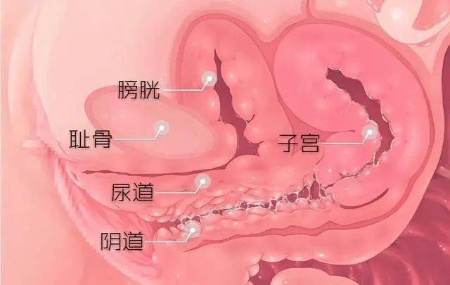 【健康知识】女性尿路感染反复发作,如何应对?