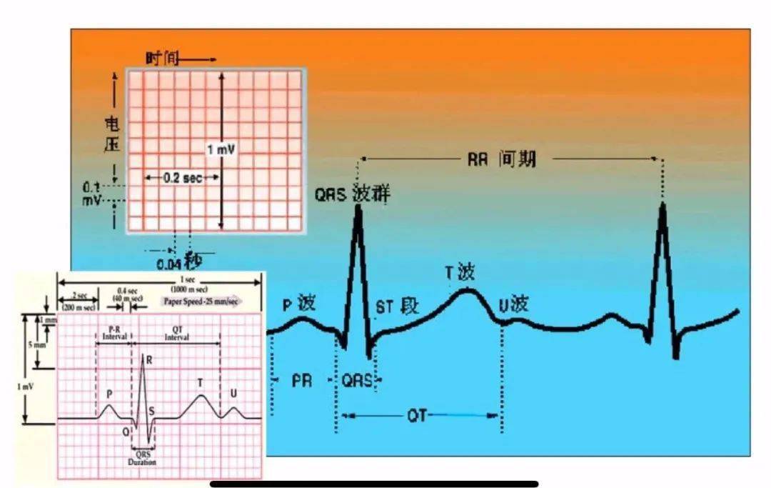 心电图各波段的测量