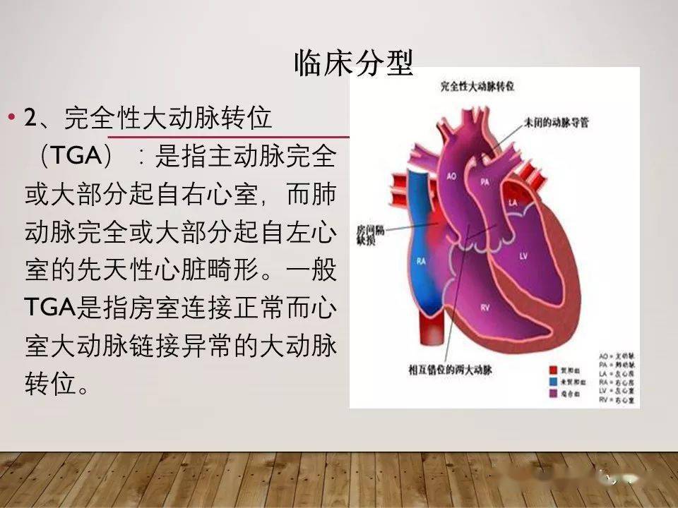 ppt大动脉转位tga的护理