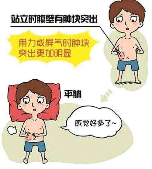 疝气有哪些危害?