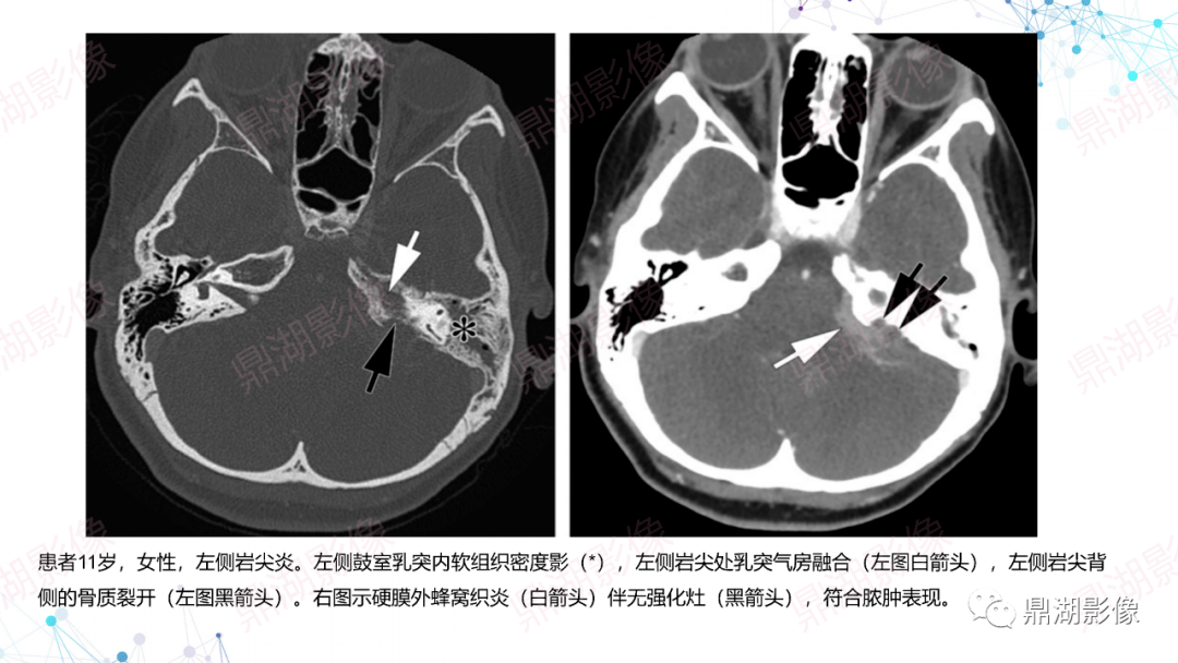 图解颈部ct影像阅片及诊断报告要点_解剖