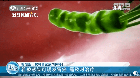 新闻网|感染幽门螺杆菌=得了胃癌？听听医生怎么说